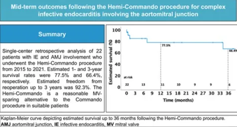 DOI: 10.1093/ejcts/ezad208