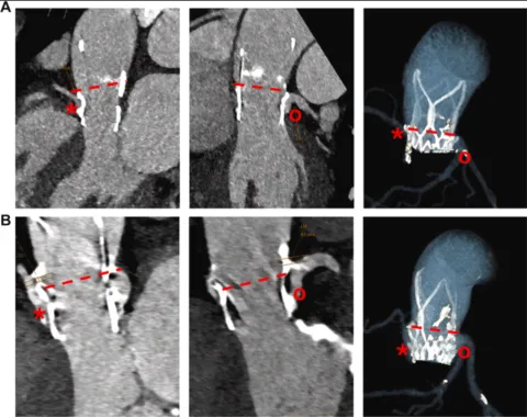 DOI: 10.1016/j.jaccas.2025.104169