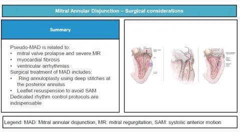 doi: 10.1093/ejcts/ezaf461.